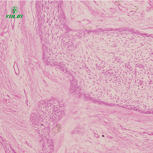 人口腔病理標(biāo)本片