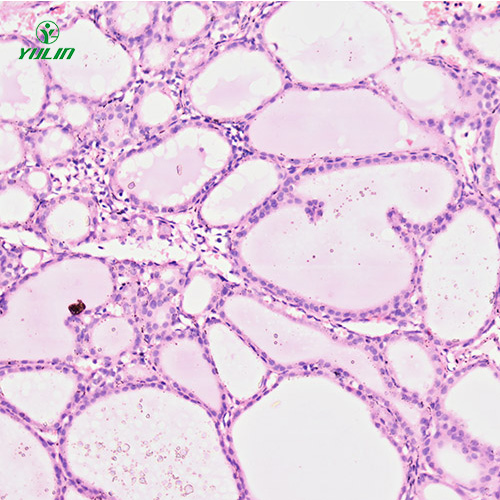 人內(nèi)分泌系統(tǒng)疾病標本片