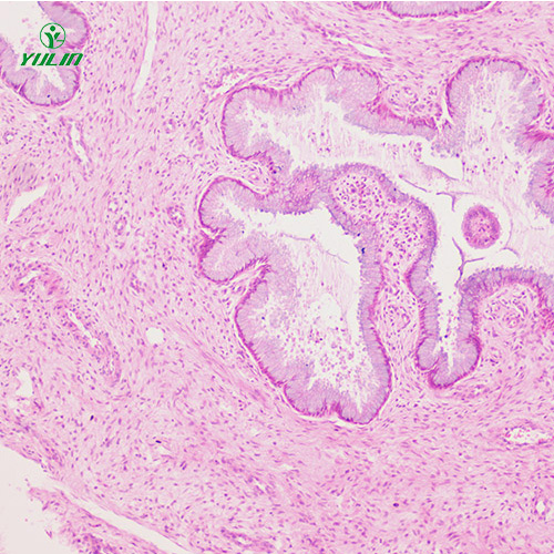 人泌尿生殖系統(tǒng)疾病標(biāo)本片