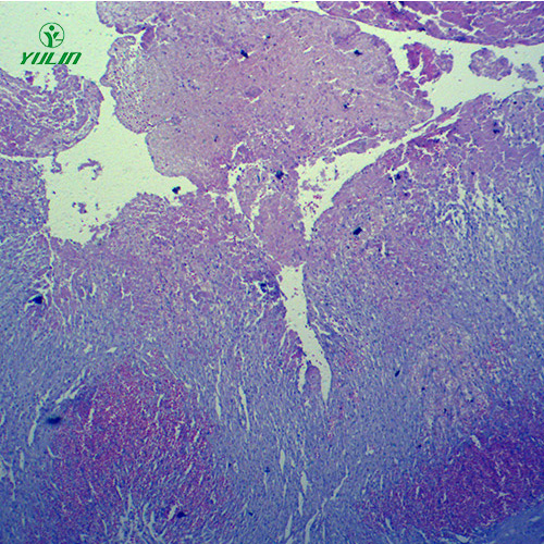 人體局部血液循環(huán)障礙病理玻片