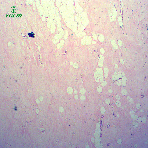 人體細(xì)胞組織損傷病理切片